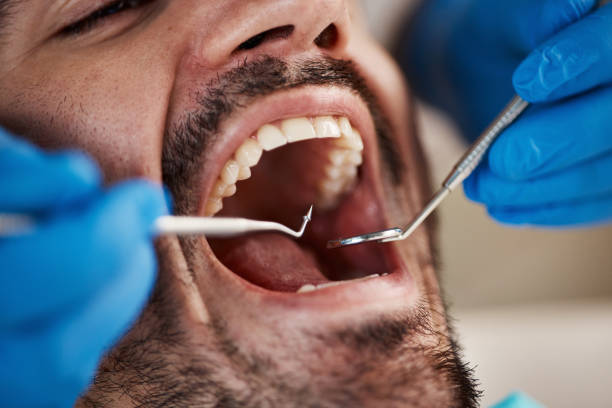 Best Pediatric Emergency Dentist in Summerside, OH